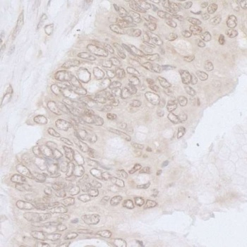 Rabbit NUP35 Antibody