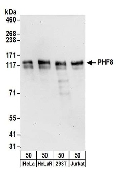 Rabbit PHF8 Antibody