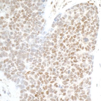 Rabbit PHF8 Antibody