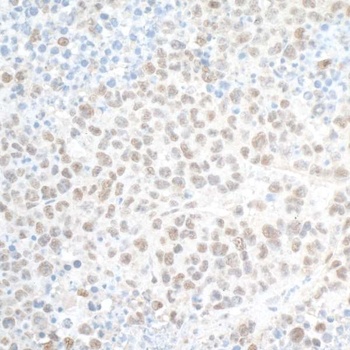 Rabbit PHF8 Antibody