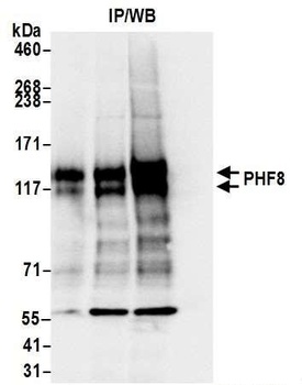 Rabbit PHF8 Antibody