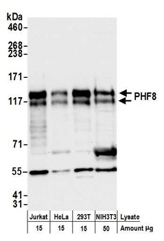 Rabbit PHF8 Antibody