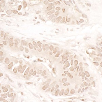 Rabbit ASH1 Antibody