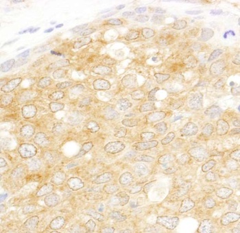 Rabbit eIF2beta/EIF2S2 Antibody