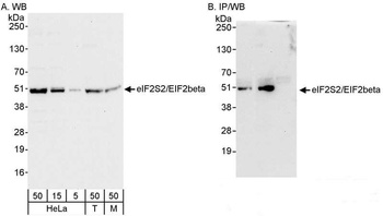 Rabbit eIF2beta/EIF2S2 Antibody