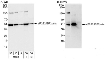 Rabbit eIF2beta/EIF2S2 Antibody