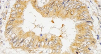 Rabbit GRB10 Antibody