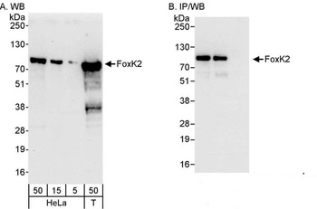 Rabbit FOXK2 Antibody