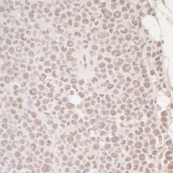 Rabbit OCT1 Antibody