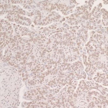 Rabbit OCT1 Antibody
