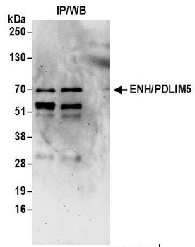 Rabbit ENH/PDLIM5 Antibody