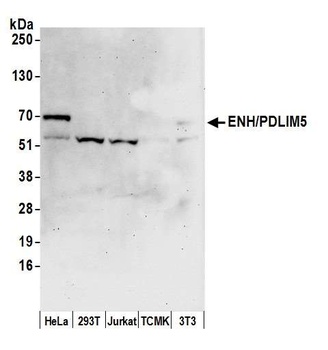 Rabbit ENH/PDLIM5 Antibody