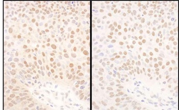 Rabbit BMI1 Antibody