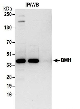 Rabbit BMI1 Antibody