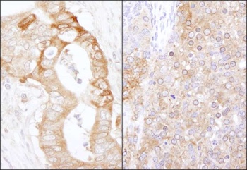 Rabbit eEF2 Kinase Antibody