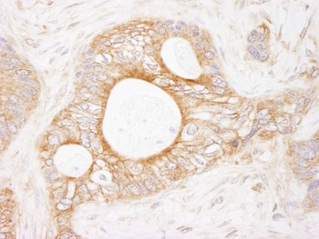 Rabbit eEF2 Kinase Antibody
