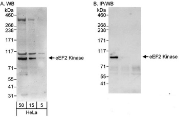 Rabbit eEF2 Kinase Antibody