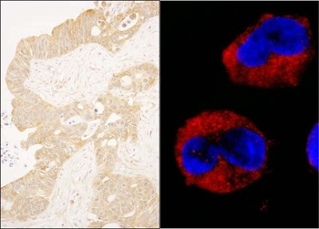 Rabbit cAbl Antibody