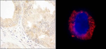 Rabbit cAbl Antibody