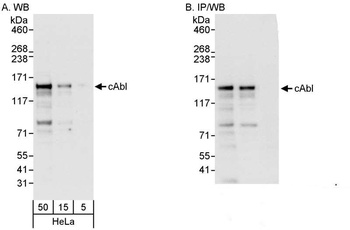 Rabbit cAbl Antibody
