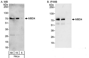 Rabbit MBD4 Antibody
