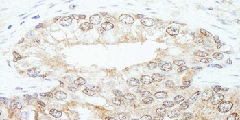 Rabbit KPNA3 Antibody