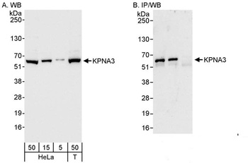 Rabbit KPNA3 Antibody