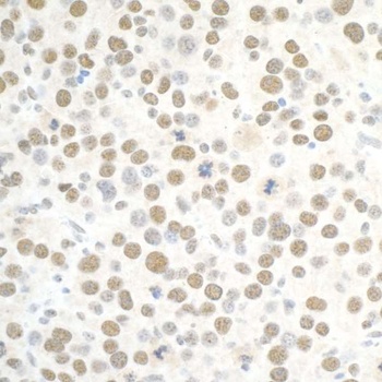 Rabbit PBRM1 Antibody