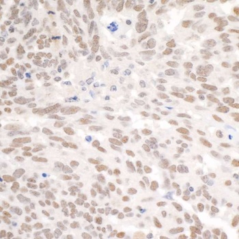 Rabbit PBRM1 Antibody