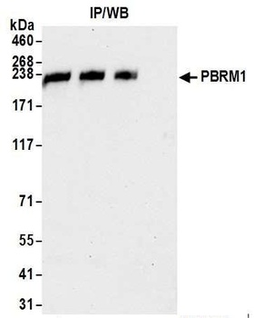 Rabbit PBRM1 Antibody