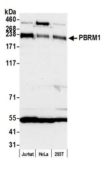 Rabbit PBRM1 Antibody