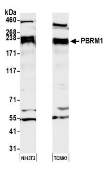 Rabbit PBRM1 Antibody