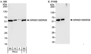 Rabbit GRWD1/WDR28 Antibody