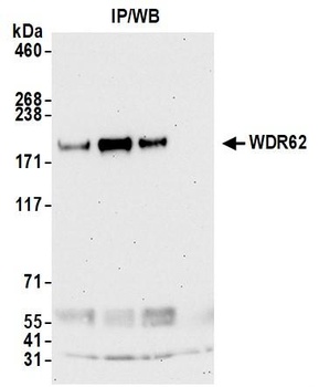 Rabbit WDR62 Antibody