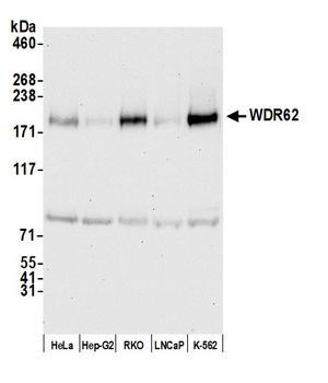 Rabbit WDR62 Antibody