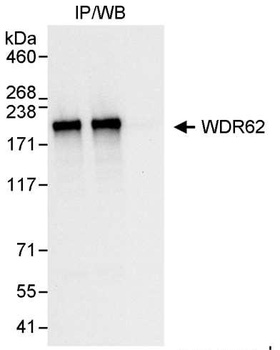 Rabbit WDR62 Antibody