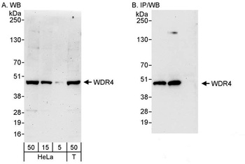 Rabbit WDR4 Antibody