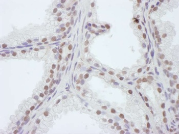 Rabbit WDR4 Antibody