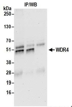Rabbit WDR4 Antibody