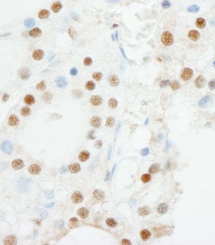 Rabbit anti-ZNF318/TZF Antibody