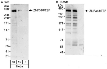 Rabbit anti-ZNF318/TZF Antibody