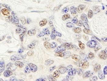 Rabbit ZNF592 Antibody