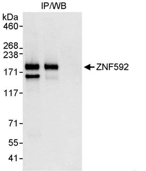 Rabbit ZNF592 Antibody