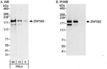 Rabbit ZNF592 Antibody