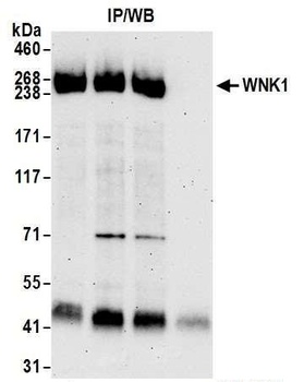 Rabbit WNK1 Antibody
