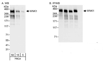 Rabbit WNK1 Antibody