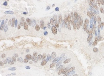 Rabbit CSTF2T/TauCSTF64 Antibody