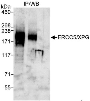 Rabbit ERCC5/XPG Antibody