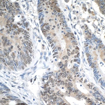 Rabbit ERCC5/XPG Antibody