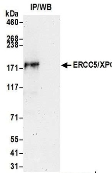 Rabbit ERCC5/XPG Antibody
